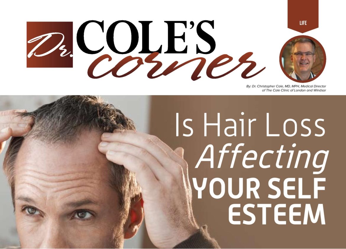 Dr. Cole’s Corner – Is Hair Loss Affecting Your Self Esteem