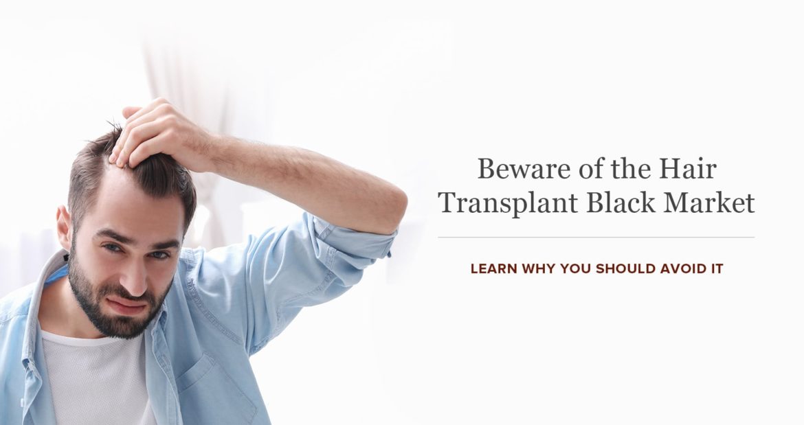 The Dangers Of The Hair Transplant Black Market | Cole Hair