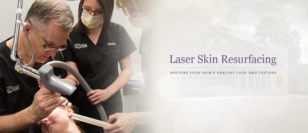 laser resurfacing